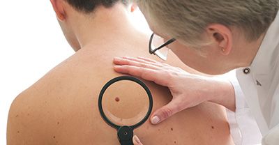 Curso de Prevenção ao Câncer de Pele Sesi