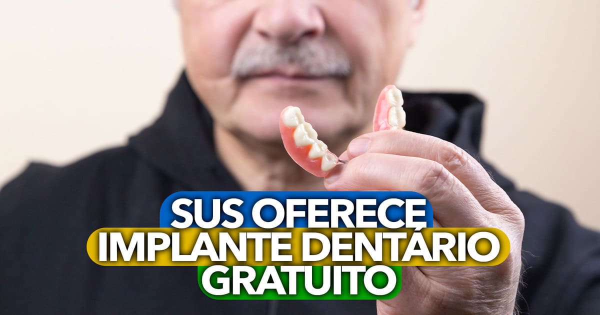 SUS offers a free dental implant: find out how to benefit