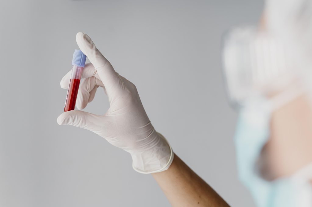Transfusão de sangue